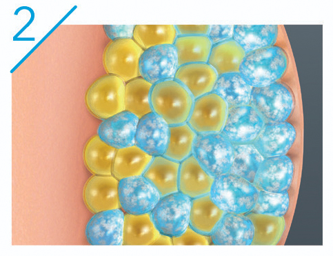 CoolSculpting® Bliss: Discover the Transformative Benefits of the