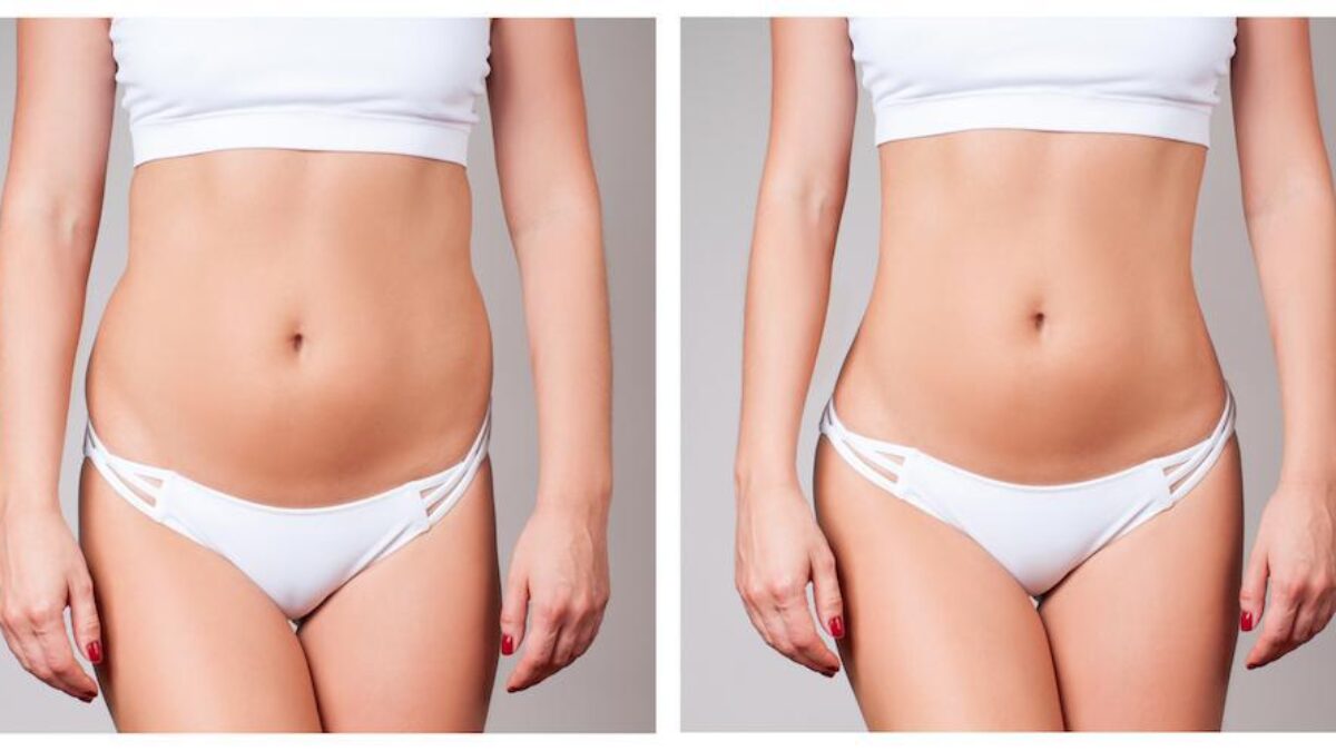 Body Sculpting Offers a Non-Surgical Solution for the perfect Silhouette -  Dolce Vita Wellness Spa
