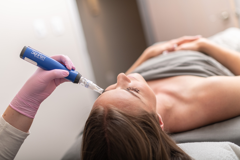 microneedling with SkinPen®