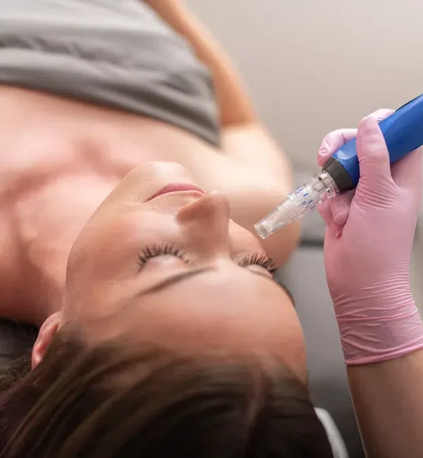 Rf-Microneedling